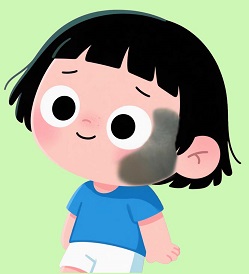青色胎记怎么回事？南京治疗青色胎记好的医院